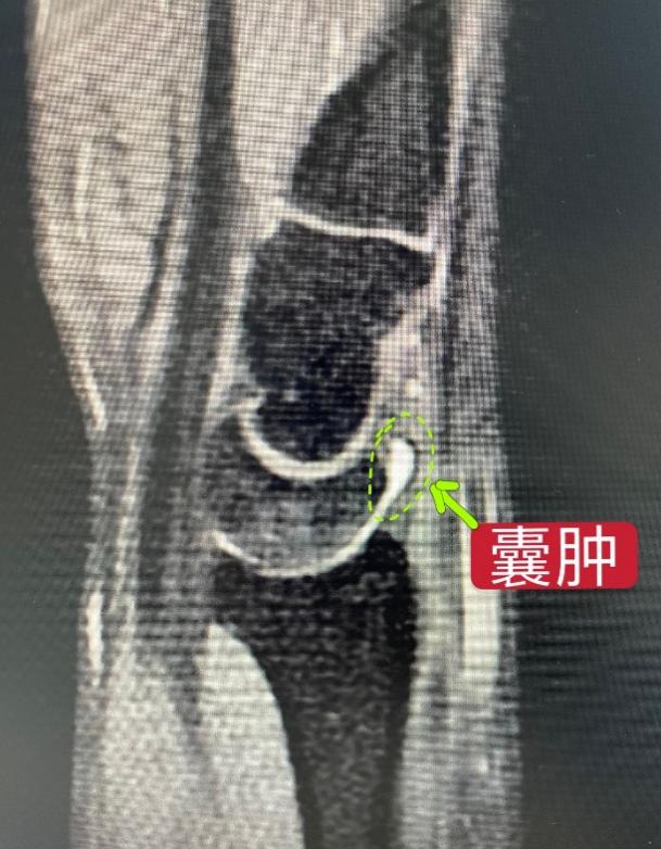 锻炼手腕疼还能锻炼吗_手腕疼到底能不能继续健身_手腕疼健身