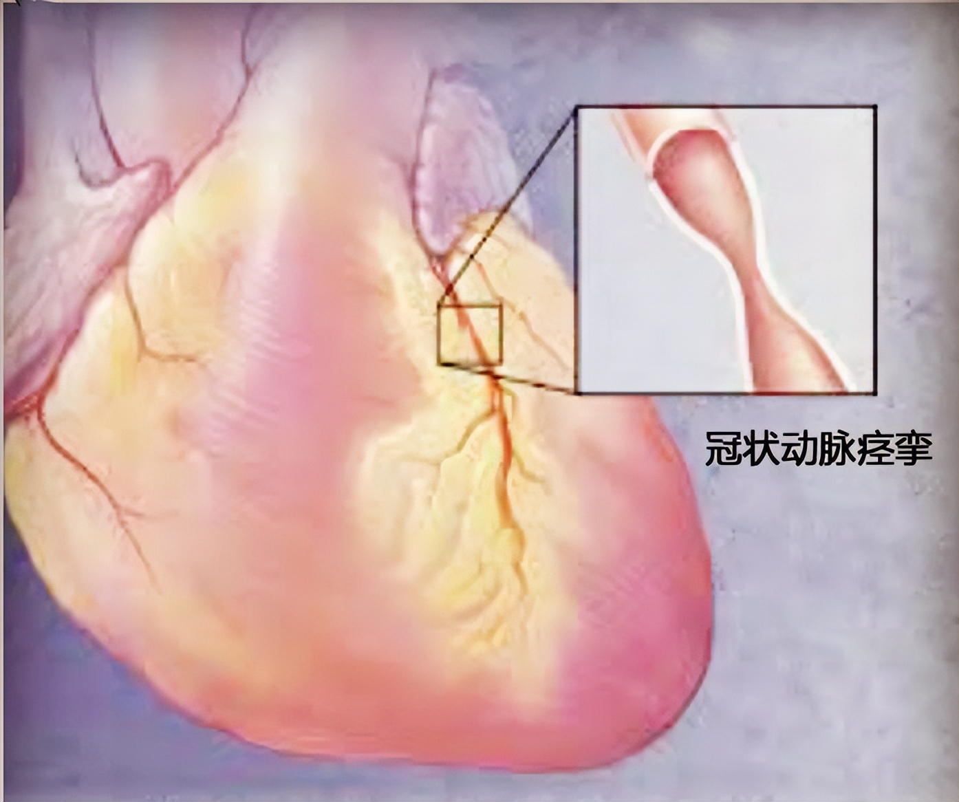 苏州马拉松猝死_苏州马拉松2022_苏州马拉松2021冠军