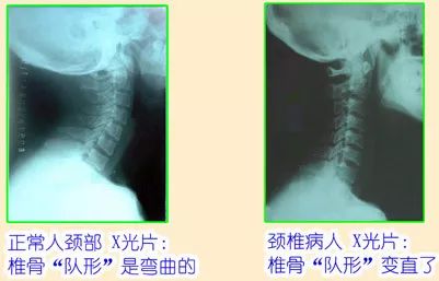 亚健康体操_亚健康操视频_亚健康健身操视频